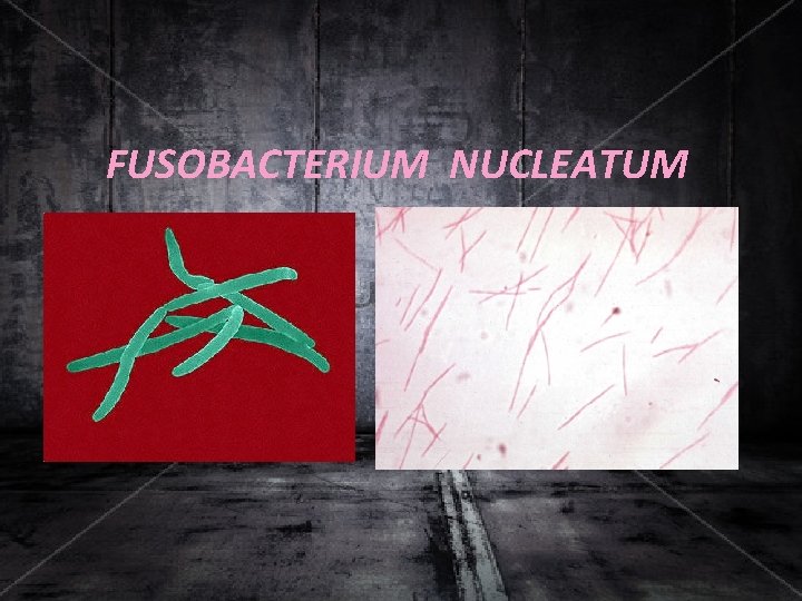 FUSOBACTERIUM NUCLEATUM 