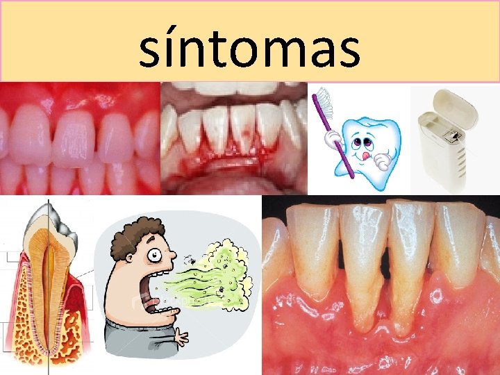 síntomas 