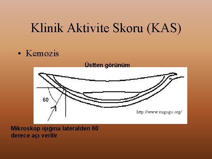 Klinik Aktivite Skoru (KAS) • Kemozis Üstten görünüm 60 http: //www. eugogo. org/ Mikroskop