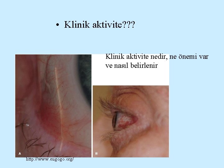  • Klinik aktivite? ? ? Klinik aktivite nedir, ne önemi var ve nasıl