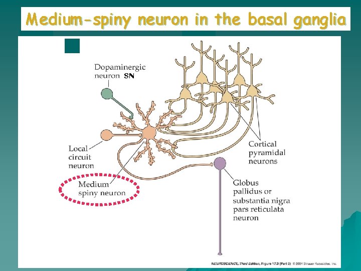 Medium-spiny neuron in the basal ganglia SN 