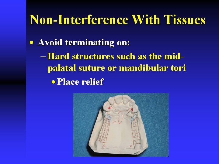 Non-Interference With Tissues · Avoid terminating on: - Hard structures such as the midpalatal