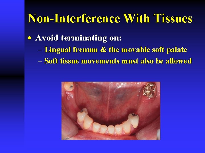 Non-Interference With Tissues · Avoid terminating on: - Lingual frenum & the movable soft