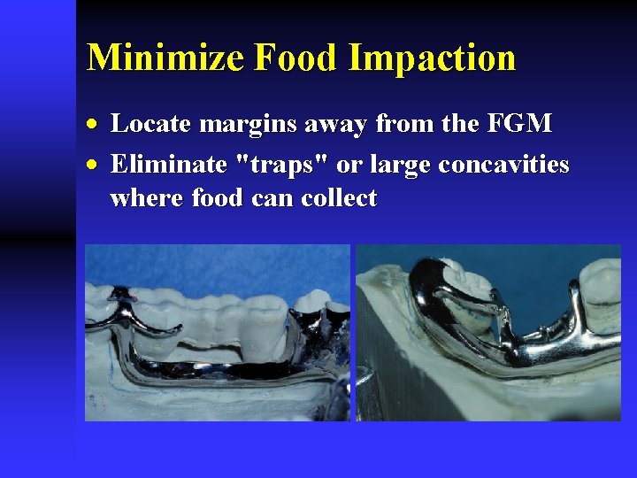Minimize Food Impaction · Locate margins away from the FGM · Eliminate "traps" or
