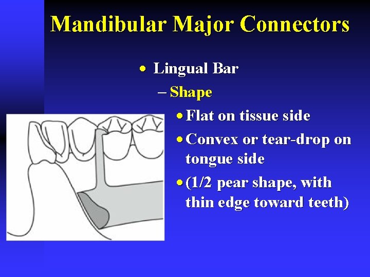 Mandibular Major Connectors · Lingual Bar - Shape · Flat on tissue side ·