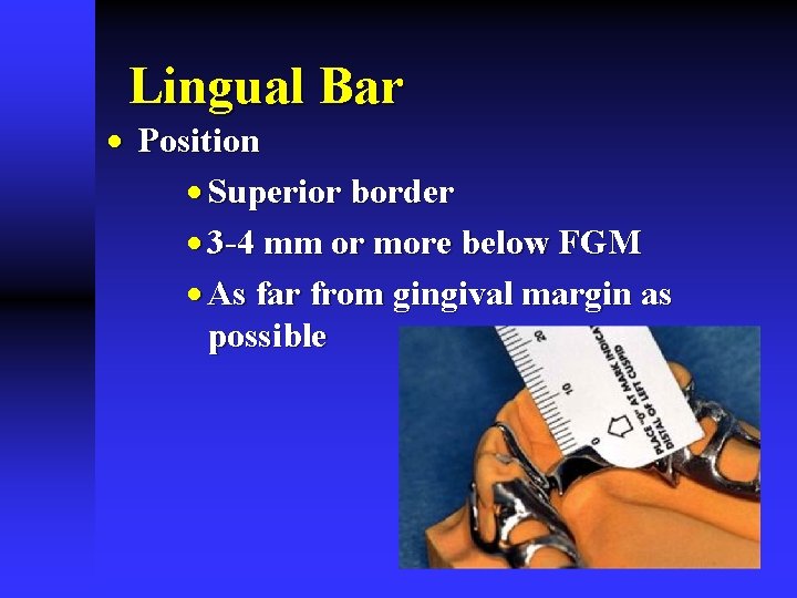 Lingual Bar · Position · Superior border · 3 -4 mm or more below