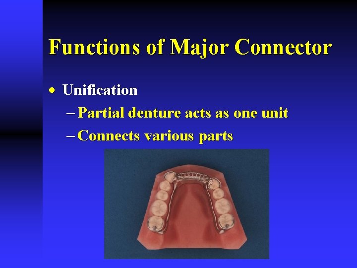 Functions of Major Connector · Unification - Partial denture acts as one unit -