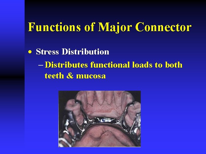 Functions of Major Connector · Stress Distribution - Distributes functional loads to both teeth