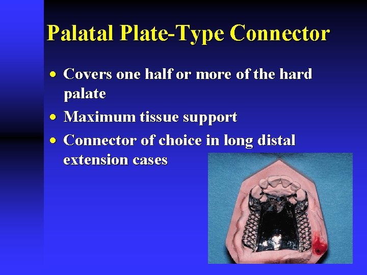 Palatal Plate-Type Connector · Covers one half or more of the hard palate ·