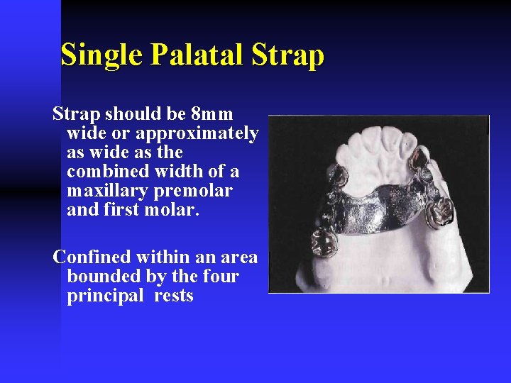 Single Palatal Strap should be 8 mm wide or approximately as wide as the