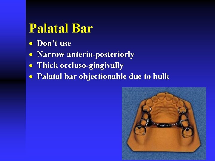 Palatal Bar · · Don’t use Narrow anterio-posteriorly Thick occluso-gingivally Palatal bar objectionable due
