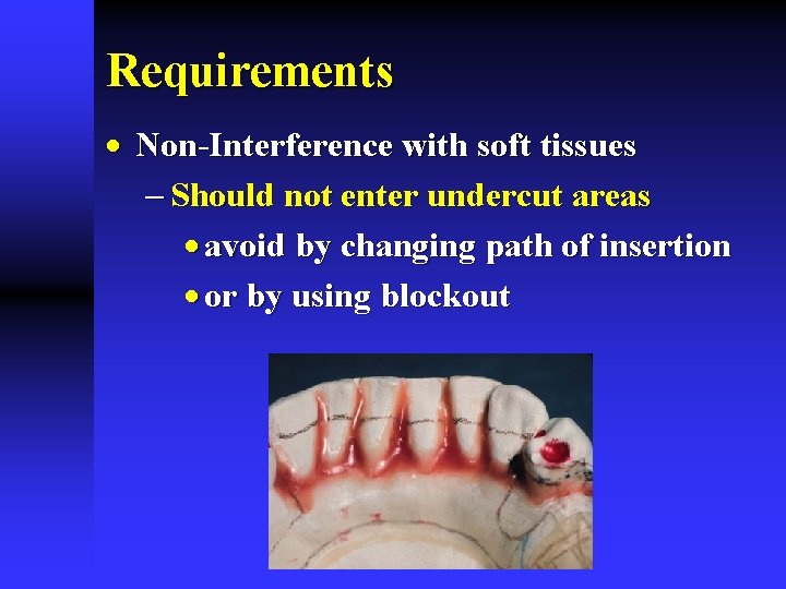Requirements · Non-Interference with soft tissues - Should not enter undercut areas · avoid