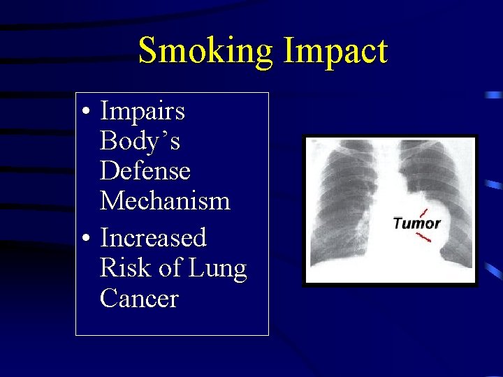 Smoking Impact • Impairs Body’s Defense Mechanism • Increased Risk of Lung Cancer 