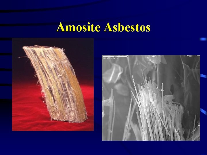 Amosite Asbestos 