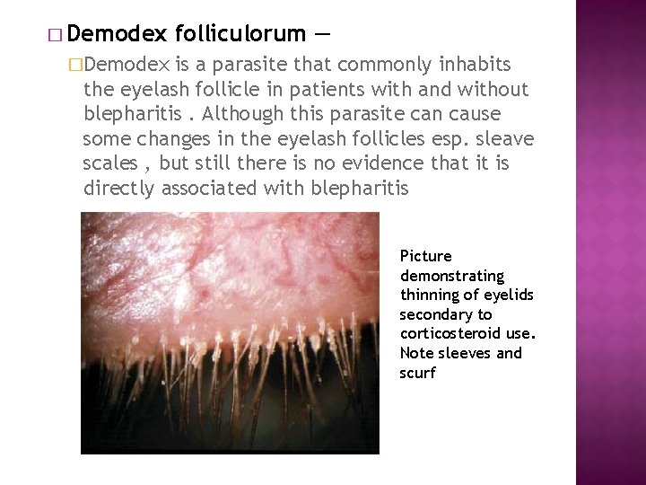 � Demodex folliculorum — �Demodex is a parasite that commonly inhabits the eyelash follicle