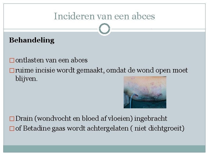 Incideren van een abces Behandeling � ontlasten van een abces � ruime incisie wordt