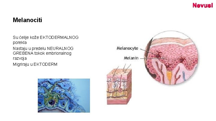 Nevusi Melanociti Su ćelije kože EKTODERMALNOG porekla Nastaju u predelu NEURALNOG GREBENA tokok embrionalnog