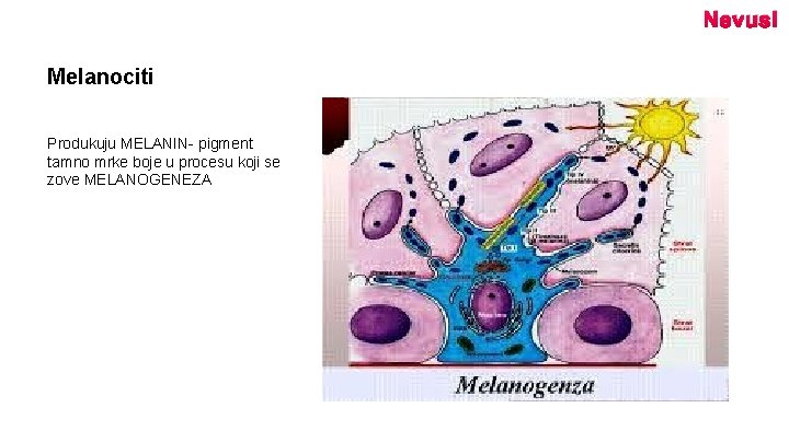 Nevusi Melanociti Produkuju MELANIN- pigment tamno mrke boje u procesu koji se zove MELANOGENEZA