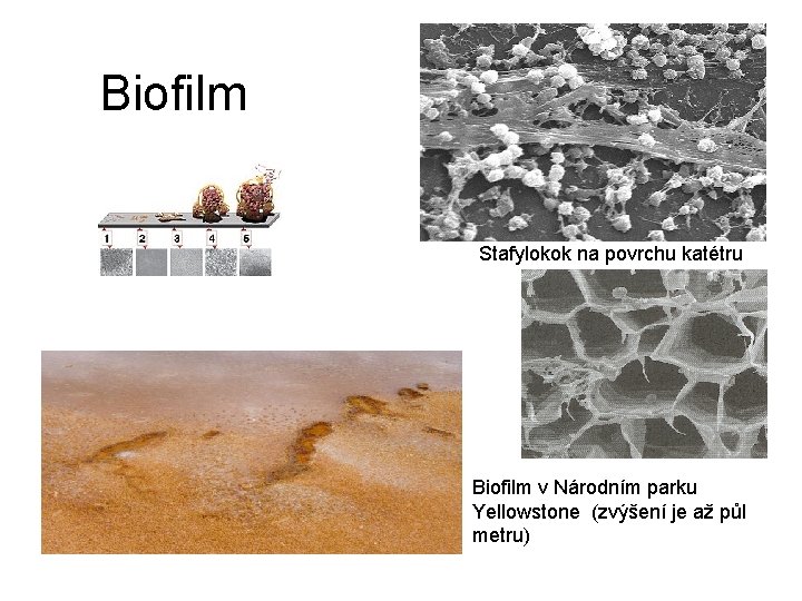 Biofilm Stafylokok na povrchu katétru Biofilm v Národním parku Yellowstone (zvýšení je až půl