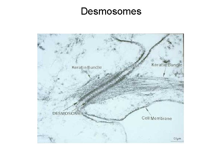 Desmosomes 