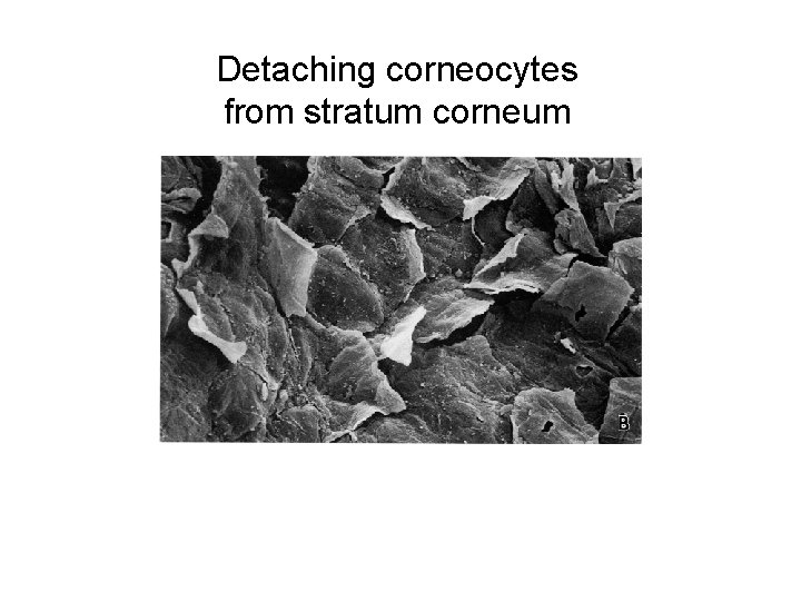 Detaching corneocytes from stratum corneum 