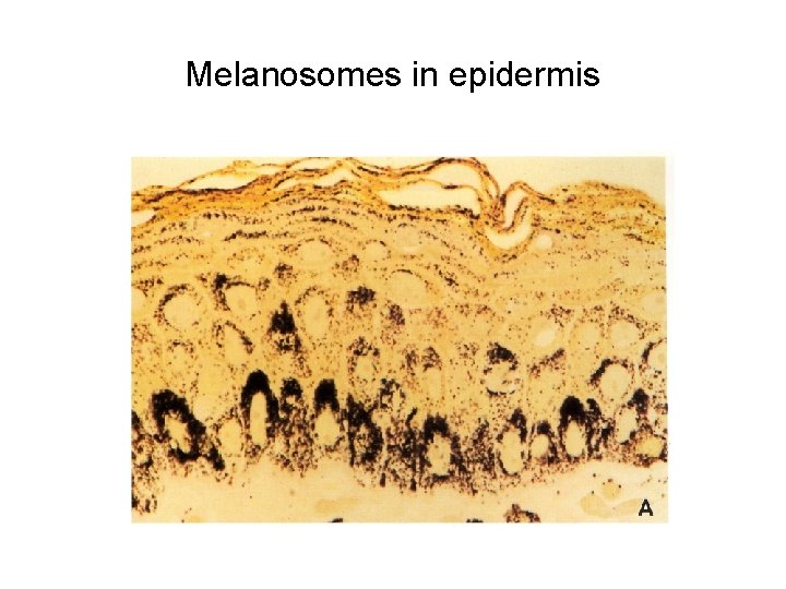 Melanosomes in epidermis 