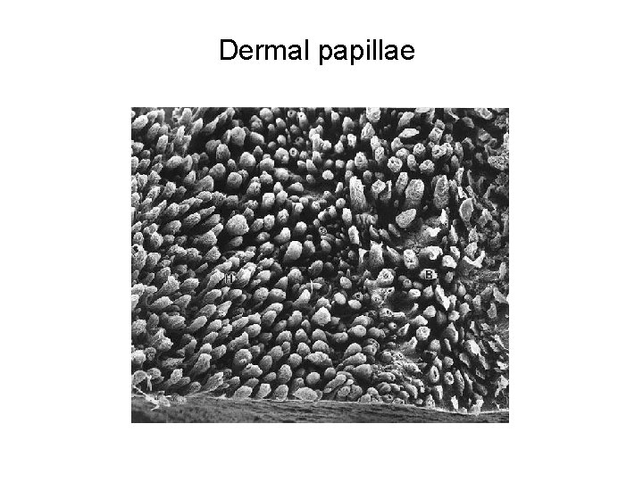 Dermal papillae 