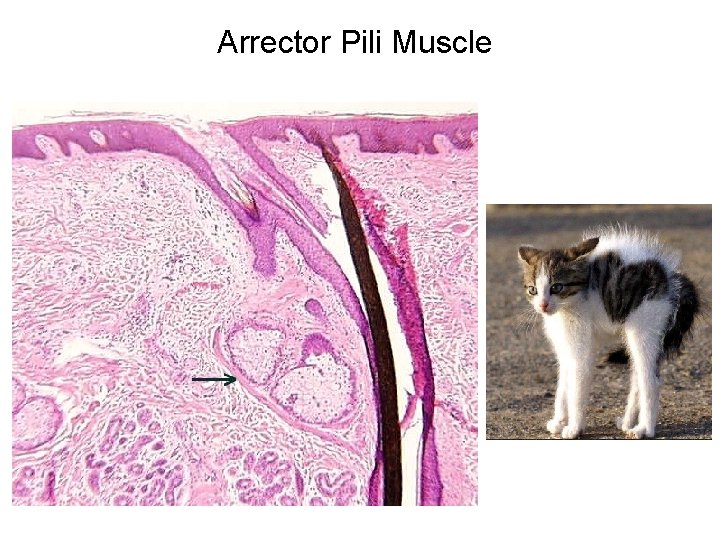 Arrector Pili Muscle 