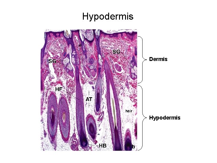 Hypodermis Dermis Hypodermis 