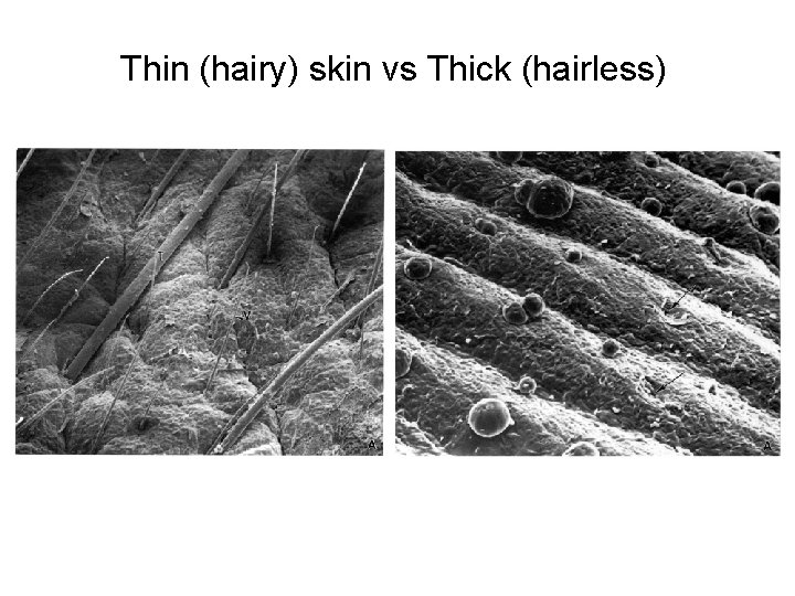 Thin (hairy) skin vs Thick (hairless) 