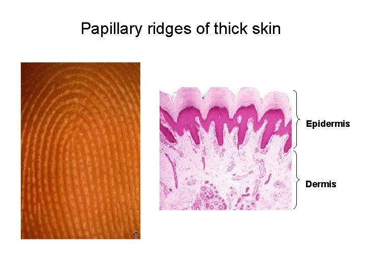 Papillary ridges of thick skin Epidermis Dermis 