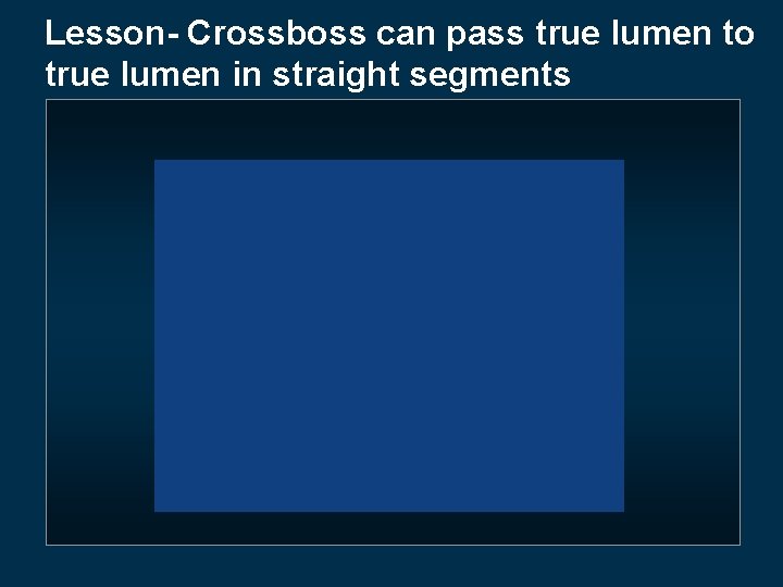 Lesson- Crossboss can pass true lumen to true lumen in straight segments 