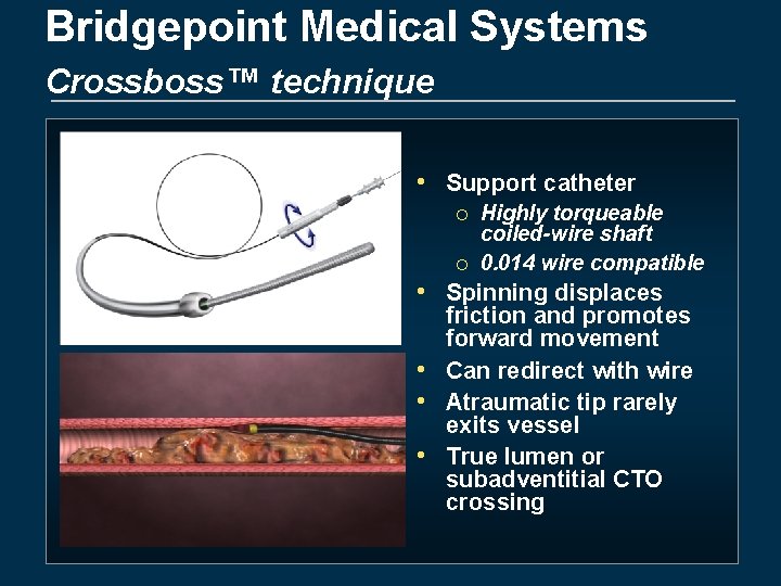 Bridgepoint Medical Systems Crossboss™ technique • Support catheter ¡ ¡ Highly torqueable coiled-wire shaft