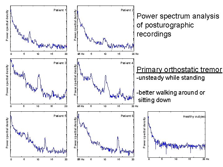 10 15 Power spectral density Patient 3 0 5 10 15 Power spectral density