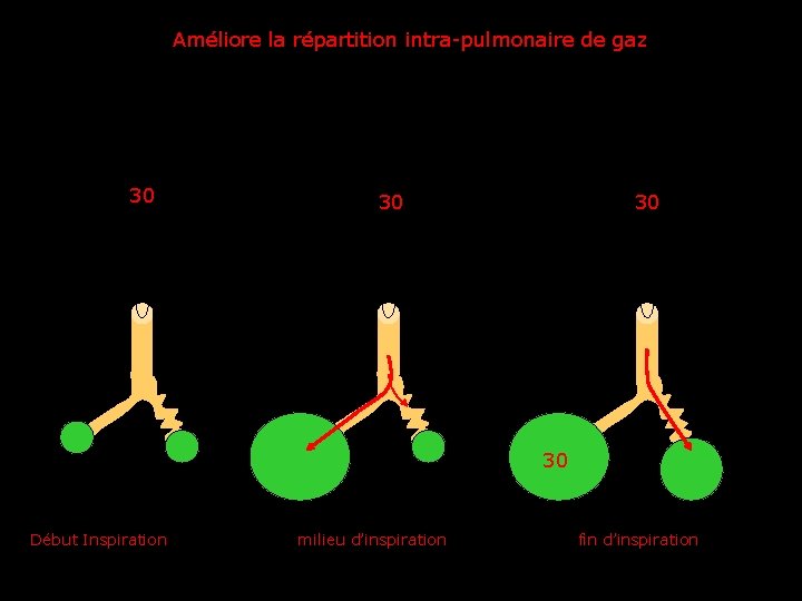 Améliore la répartition intra-pulmonaire de gaz 30 30 Début Inspiration milieu d’inspiration fin d’inspiration