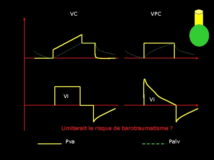  VC VPC Vi Vi Limiterait le risque de barotraumatisme ? Pva Palv 