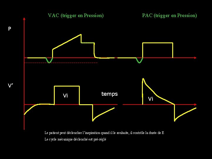 VAC (trigger en Pression) PAC (trigger en Pression) P V’ Vi temps Vi Le