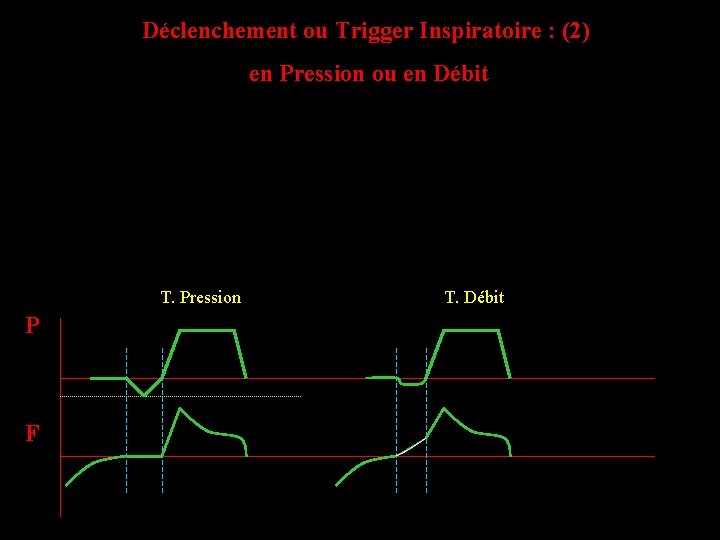 Déclenchement ou Trigger Inspiratoire : (2) en Pression ou en Débit T. Pression T.