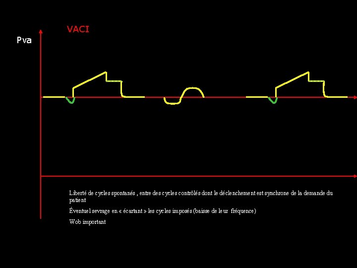 VACI Pva Liberté de cycles spontanés , entre des cycles contrôlés dont le déclenchement