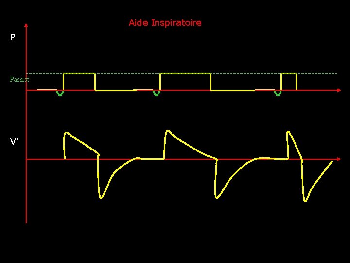 Aide Inspiratoire P Passist V’ 