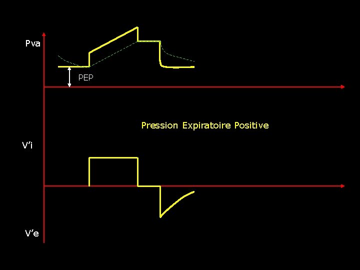 Pva PEP Pression Expiratoire Positive V’i V’e 