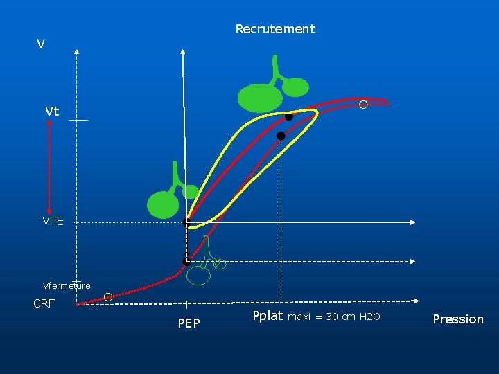 Recrutement V Vt VTE Vfermeture CRF PEP Pplat maxi = 30 cm H 2