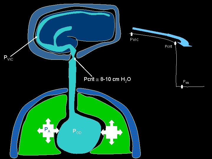 Pvic Pcrit PVIC Pcrit 8 -10 cm H 2 O PA POD 