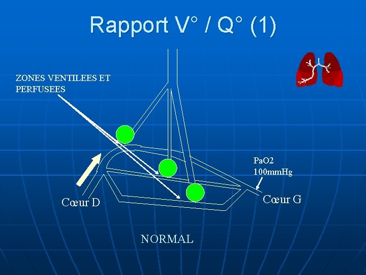 Rapport V° / Q° (1) ZONES VENTILEES ET PERFUSEES Pa. O 2 100 mm.