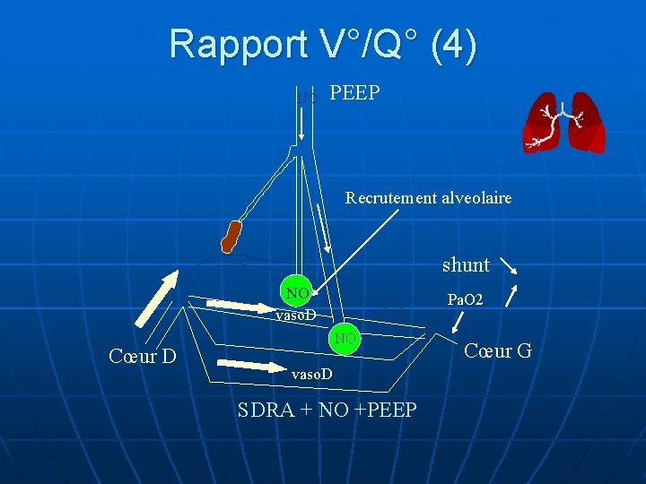 Rapport V°/Q° (4) NO PEEP Recrutement alveolaire shunt NO vaso. D Cœur D Pa.