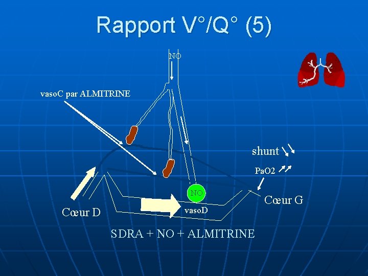 Rapport V°/Q° (5) NO vaso. C par ALMITRINE shunt Pa. O 2 NO Cœur