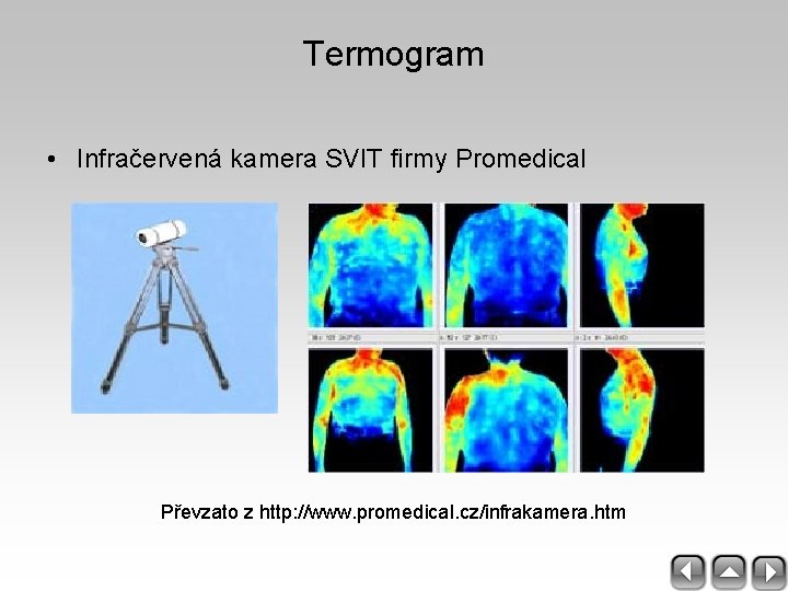 Termogram • Infračervená kamera SVIT firmy Promedical Převzato z http: //www. promedical. cz/infrakamera. htm