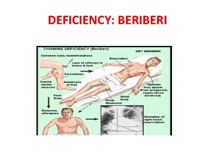 DEFICIENCY: BERI 