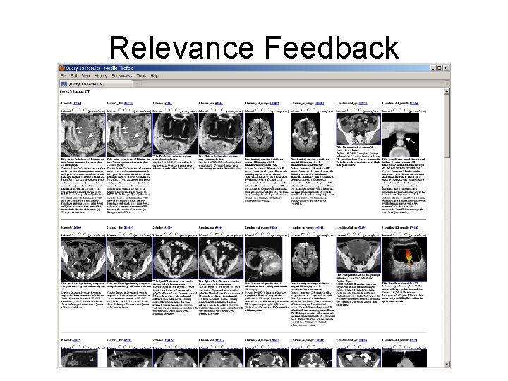 Relevance Feedback 