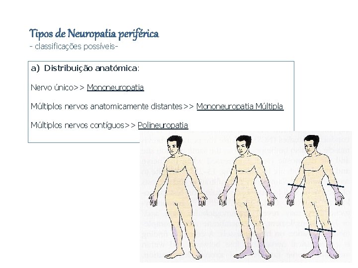 Tipos de Neuropatia periférica - classificações possíveis- a) Distribuição anatómica: Nervo único>> Mononeuropatia Múltiplos